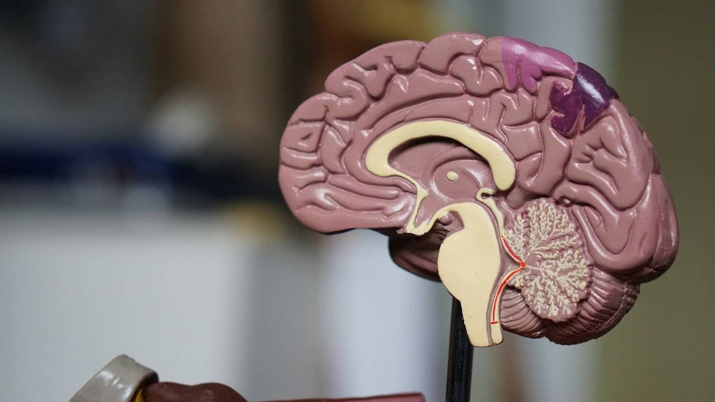Anatomical brain model